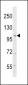 RANBP17 Antibody (N-term)
